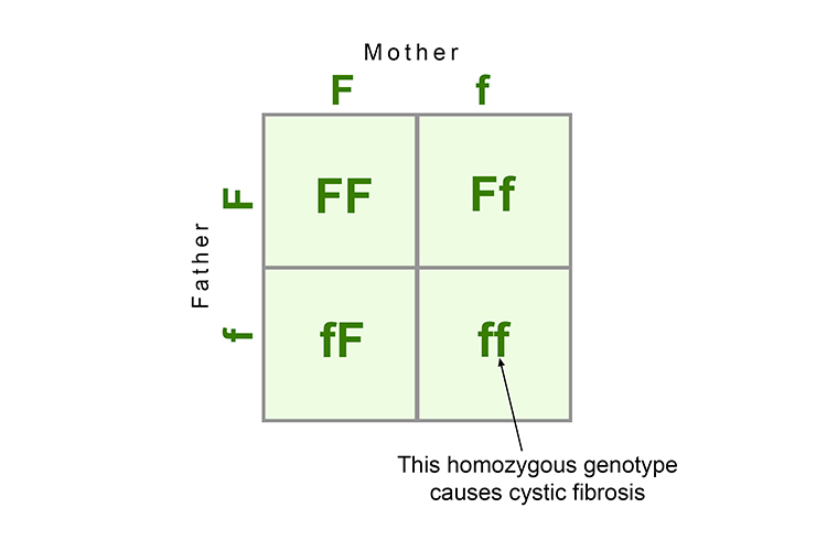 Simplified punnet squares showing the dominant and recessive cystic fibrosis genotypes